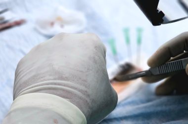 immunotherapy liver transplantation