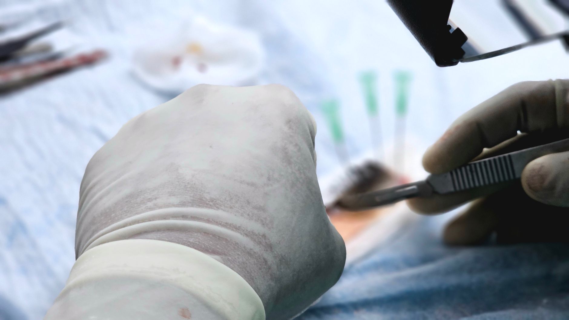 immunotherapy liver transplantation